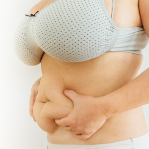 Non-surgical Weight Loss Procedures in Mclean
