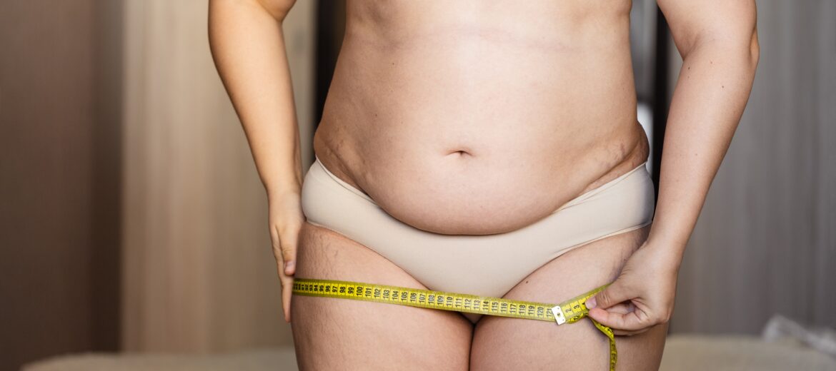 Bariatric Surgery in Northern Virginia